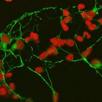 Cells with red nuclei and long green processes