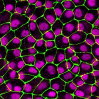 Retinal pigment epithelial cells stained green and magenta