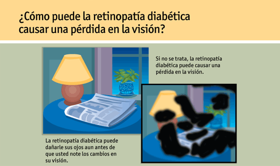 Página 6: ¿Cómo puede la retinopatía diabética causar una pérdida de la visión?