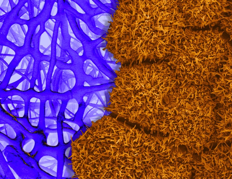RPE cells and scaffolding