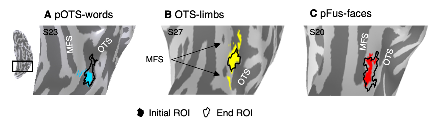 illustrations of three regions from within the ventral temporal cortex. 