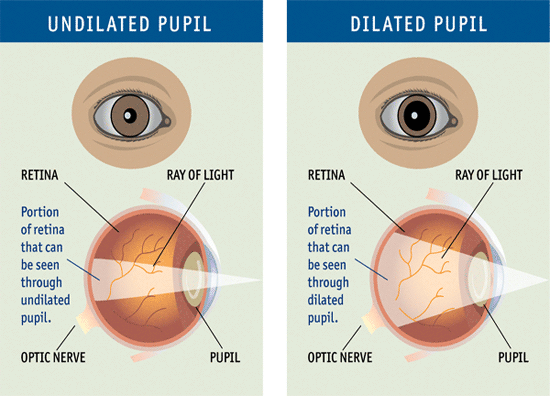 Dilation and attraction pupil 7 Causes