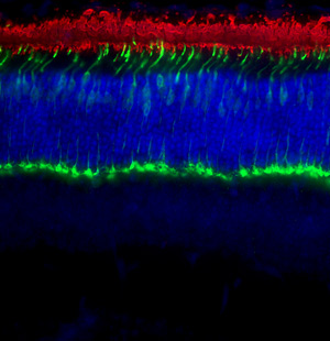 This cross-section of the retina has been stained to reveal the two main types of photoreceptors: rods (in red) and cones (green). Credit: Dr. Krzysztof Palczewski, Case Western.