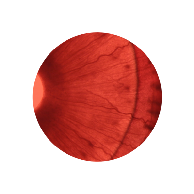 a microscopic view of an eyeball