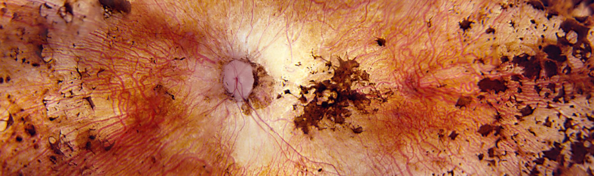 microscopic image of an eye