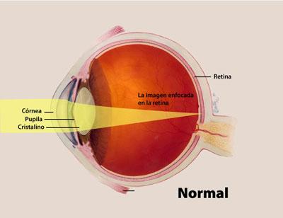 Diagrama de los partes del ojo normal