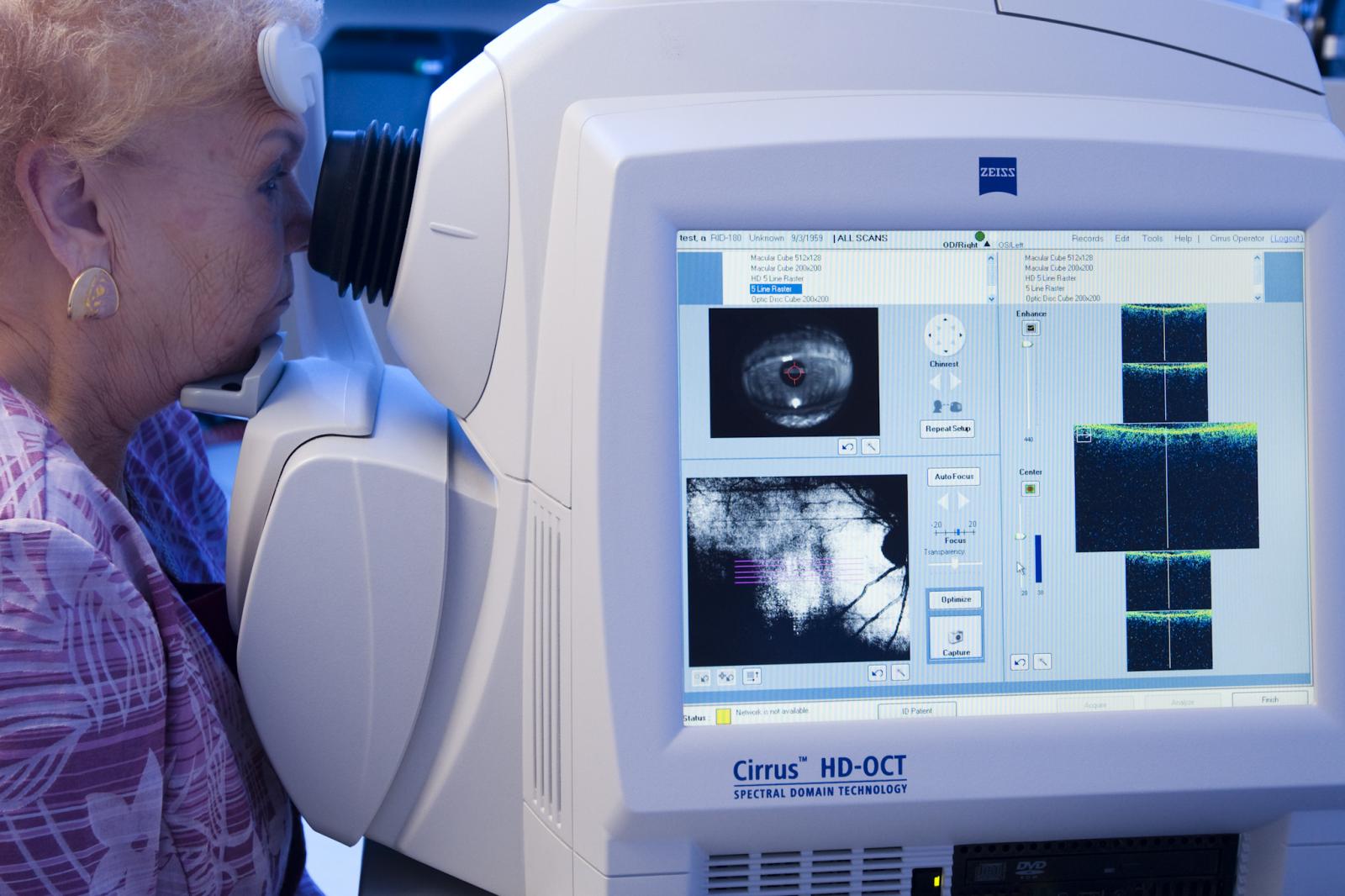 female patient having optical coherence tomography (OCT) performed to image the retina