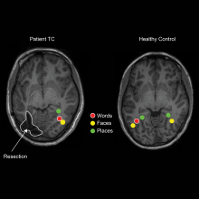 fMRI brain scan shows activity in two different brains