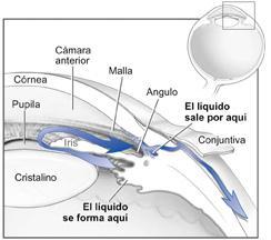 Diagrama de del ojo que muestra la salida de liquido que se ve en pacientes con glaucoma