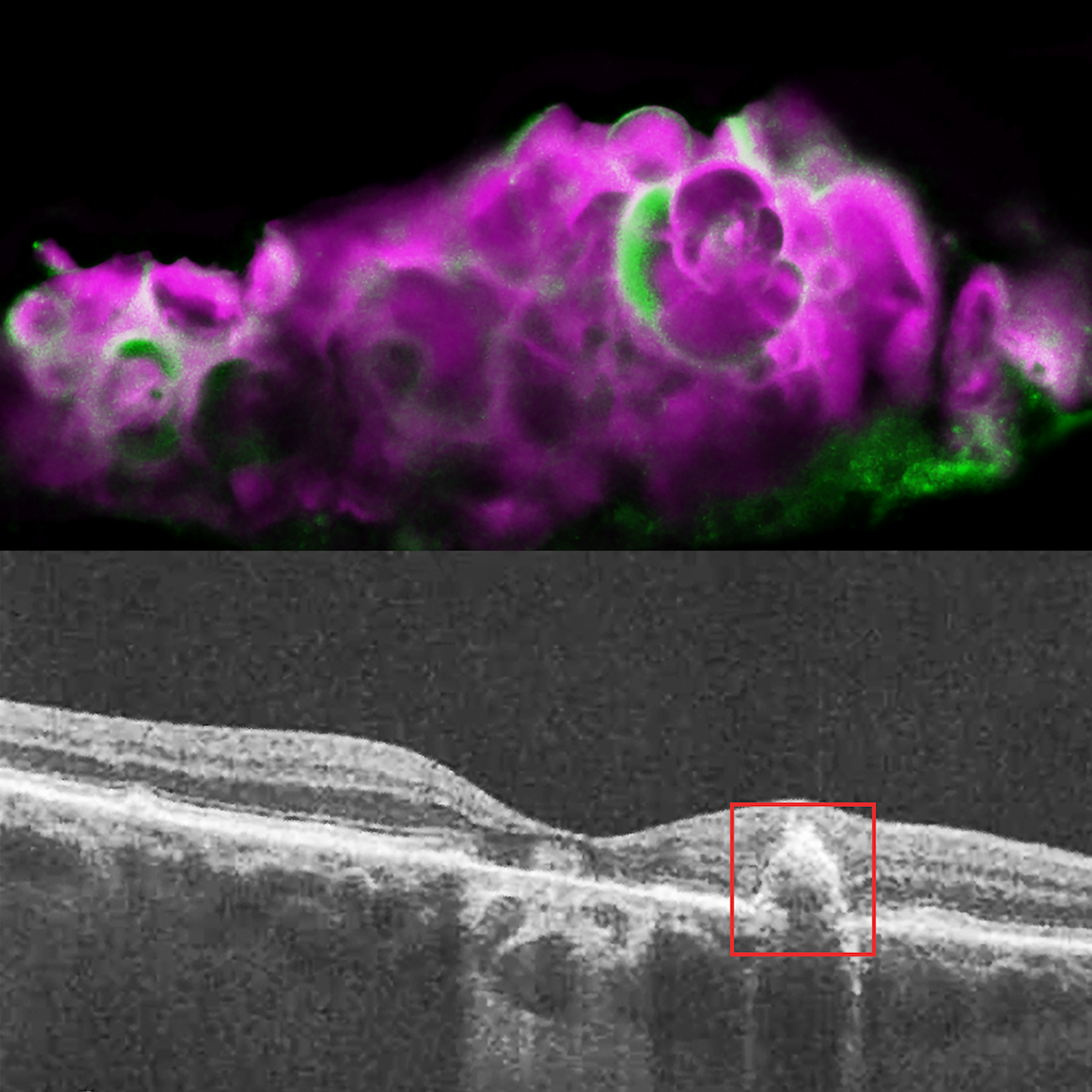 Images of dry AMD retina
