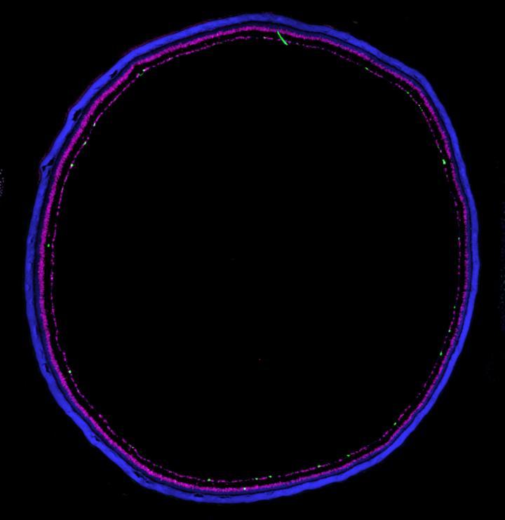 Purple, pink, white rings showing fluorescence from retina section