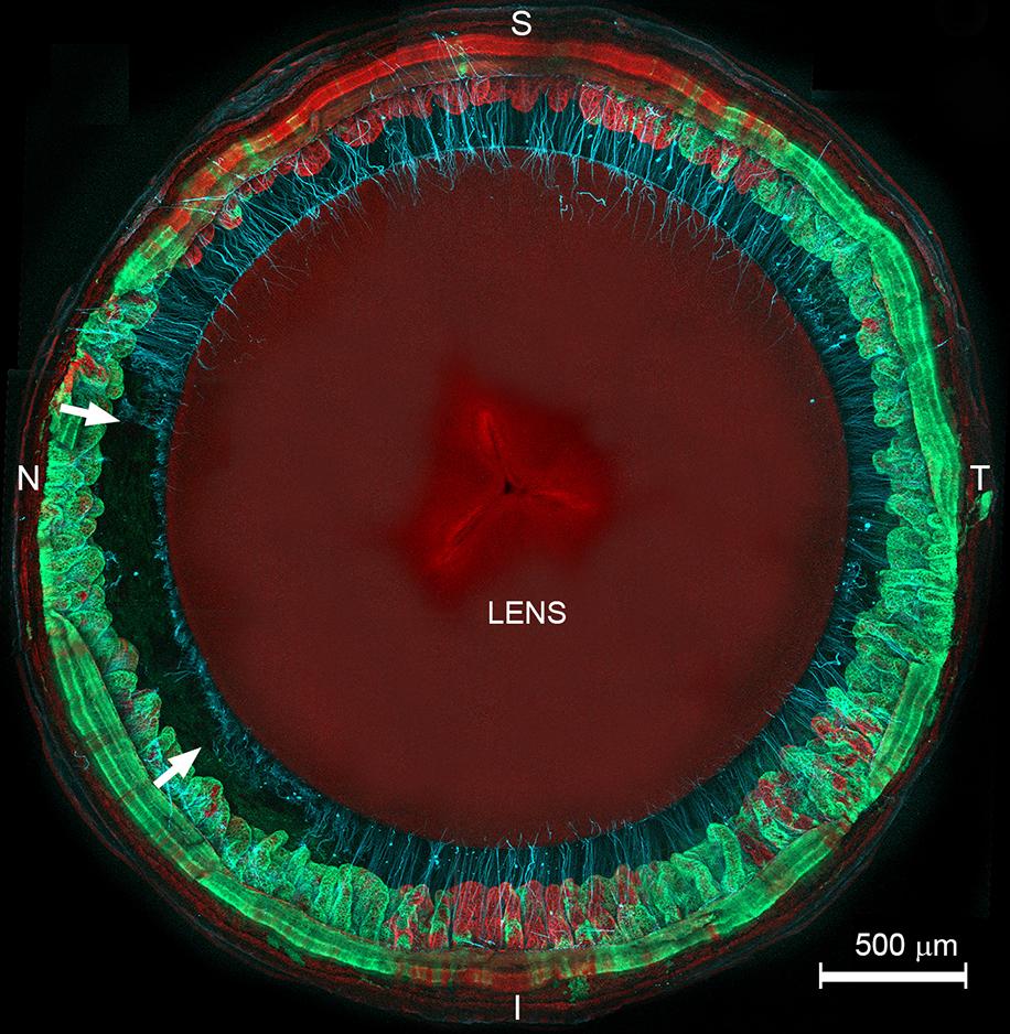 Microscopy image of lens and zone fibers stained red, blue and green.