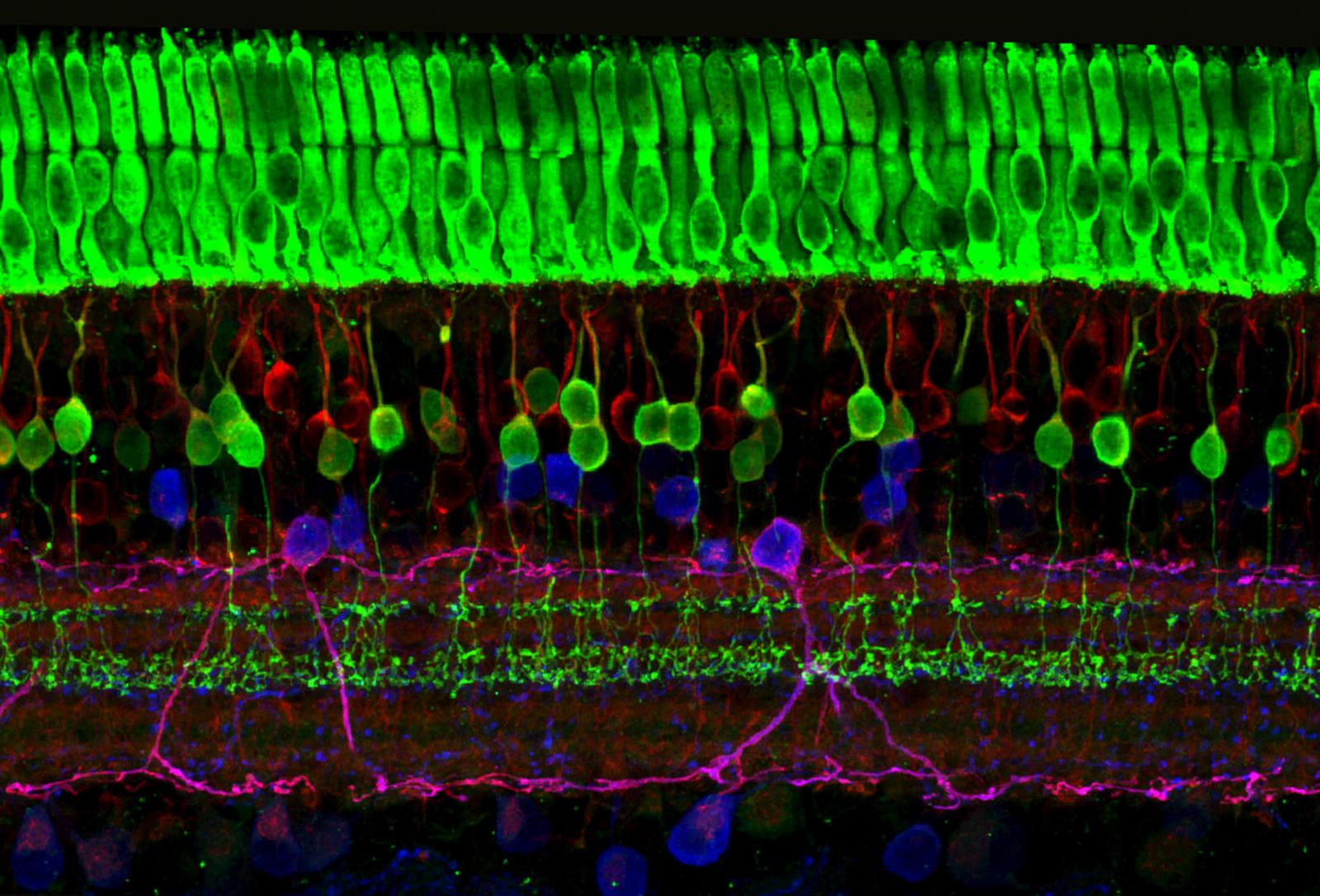 A ground squirrel retina cross-section labeled with antibodies against recoverin (green), calretinin (red) and PKA (blue).