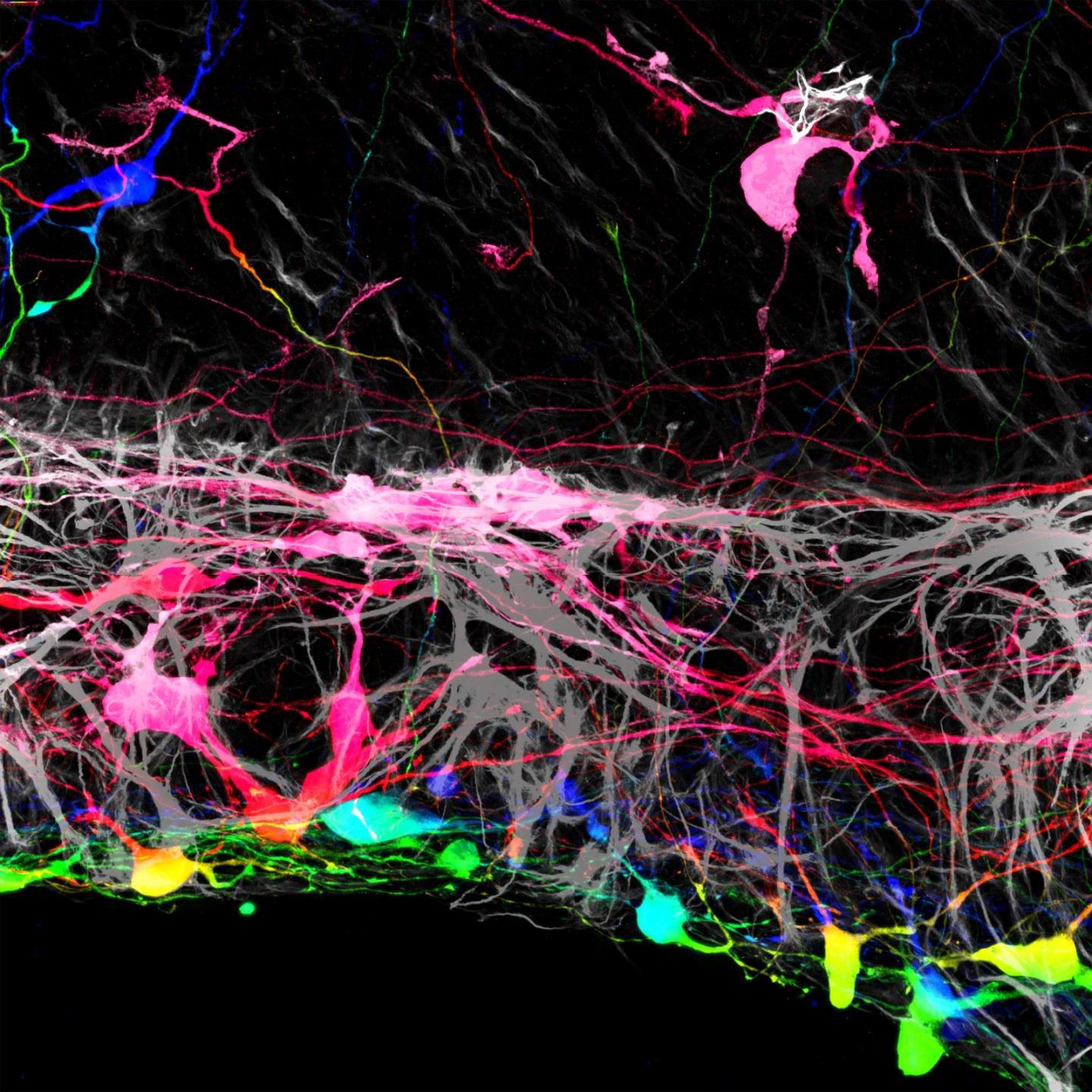 Multicolored nerve cells with many dendrites
