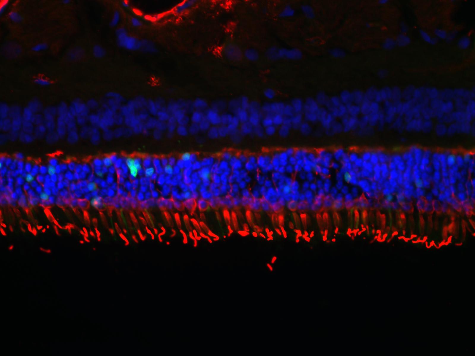 Image shows cone cells, labeled in red.