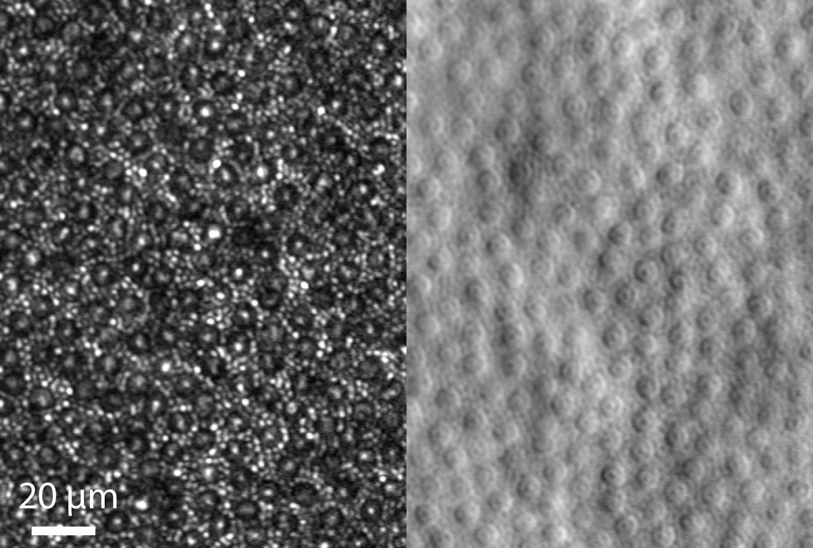 Rod and cone photoreceptors are shown in greyscale images.