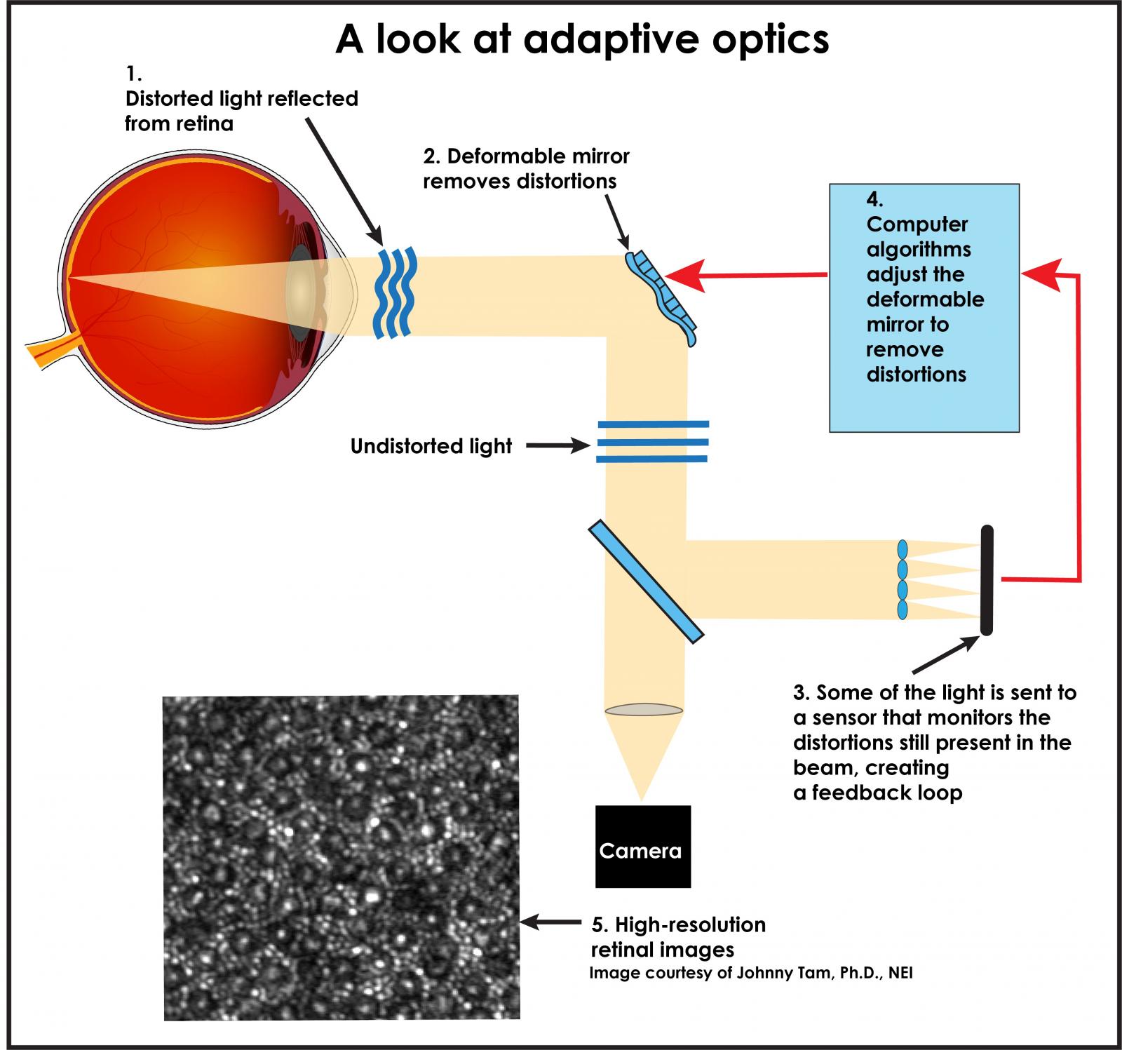 Diagram shows a look at adaptive optics: 1. distorted light is shown reflected from the retina. 2) Deformable mirror removes distortions. Light is undistorted. 3. Some of the light is sent to a sensor that monitors the distortions still present in the beam, creating a feedback loop. 4. Computer algorithms adjust the deformable mirror to remove distortions. 5. the undistorted light is captured by a camera, which produces a high resolution retinal image. photo shows black and white images of photoreceptors.