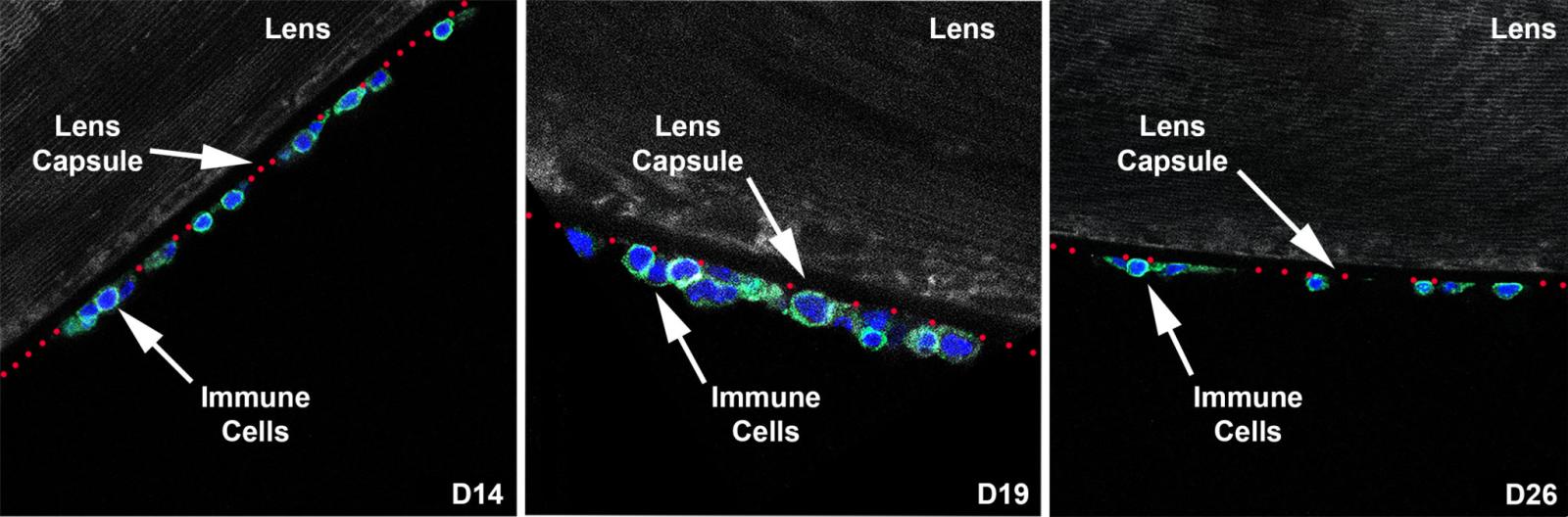 Immune cells lining the lens capsule
