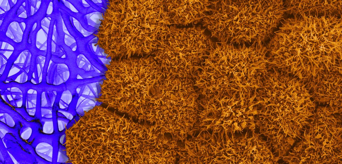 RPE cells and scaffolding