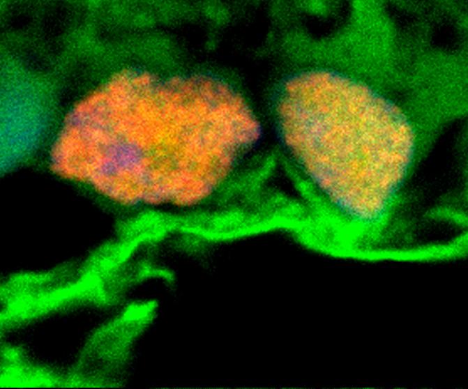 Photo shows microscopy image of exosomes in green surrounding rentinal ganglion cells in yellow and orange.