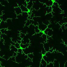 Black and green microscopic image of a mouse retina. 