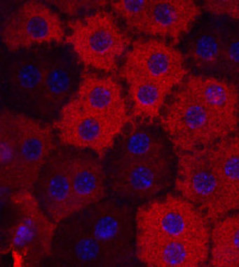 Retinal pigment epithelial (RPE) cells stained red by RPE65 antibody.
