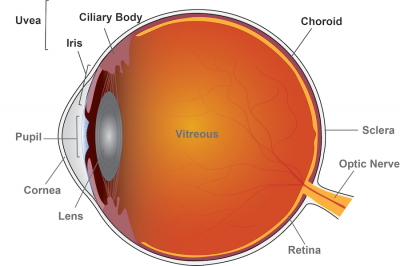 Schematic showing areas of eye affected by uveitis