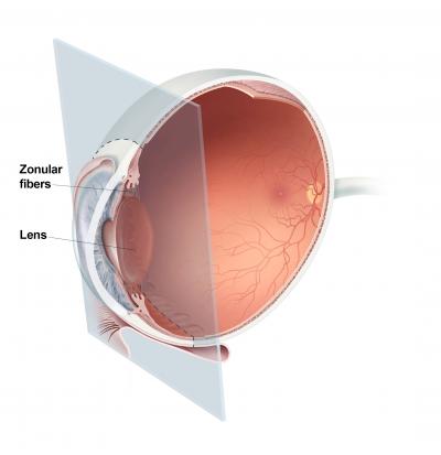 Cross section of eye showing location of lens and zonular fibers