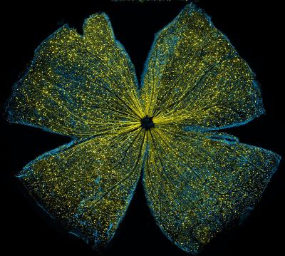 Retina flattened to 4 lobes, stained yellow and blue