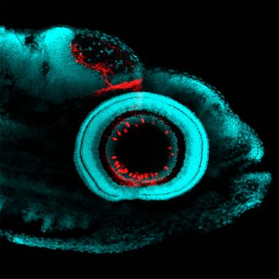 Fluorescent image of zebrafish eye, highlighting RGCs