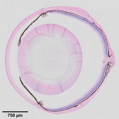 Cross-section of a mouse eye, stained in pink and brown