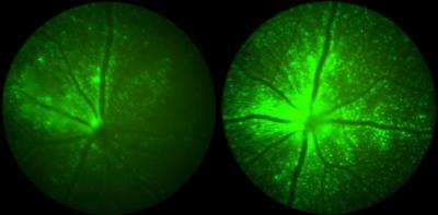 Retinas with lower (left) and higher (right) green fluorescence