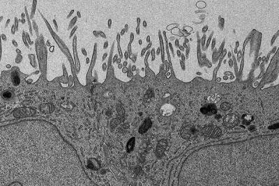 Grey scale electron microscopy image of human retinal cells.