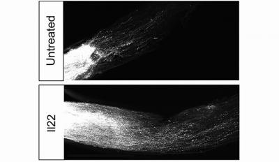 Images of untreated versus Il22 treated optic nerve fibers