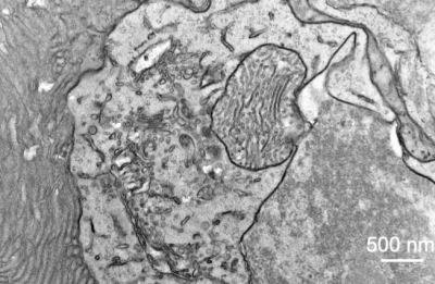 Grayscale transmission electron micrograph of a cell with mitochondrion