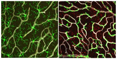 Side-by-side panels showing retinal vessels. Left panel filled with green, right panel much less green.