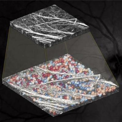 Slice of OCT image hovers over 3D segmentation of retinal cells