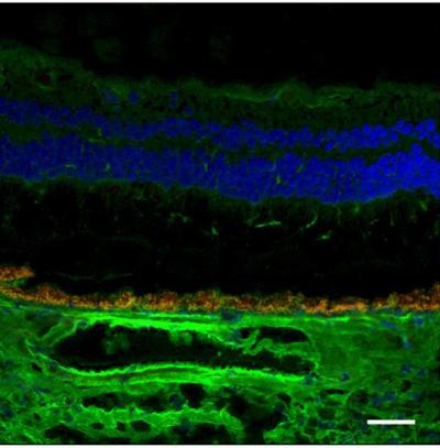 In this tissue section of the human retina, bright green demonstrates the presence of the protein product of CFH gene. A variant form of the CFH gene increases the risk for age-related macular degeneration.