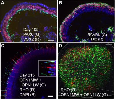 Four images showing retinal organoids at different stages of development.