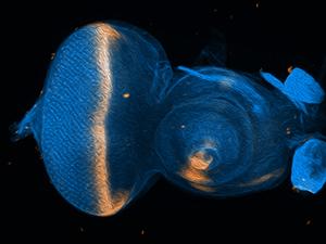 Fruit fly eye-antennal imaginal disc showing line of dpp staining.