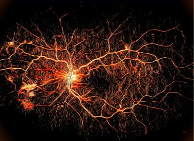 Artistic rendering of retinal blood vessels with blood vessel damage.