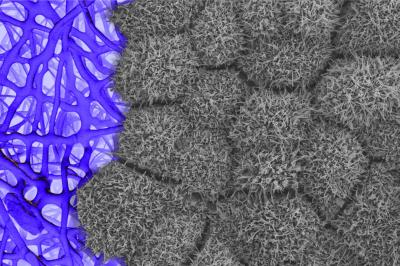 gray cells growing on a purple matrix