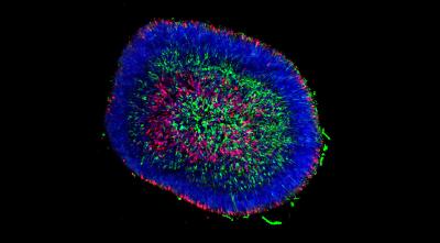 retinal organoid