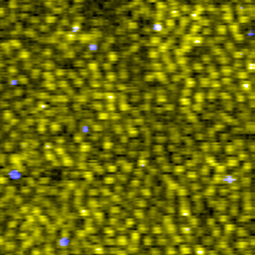 Cone photoreceptor mosaic visualized 