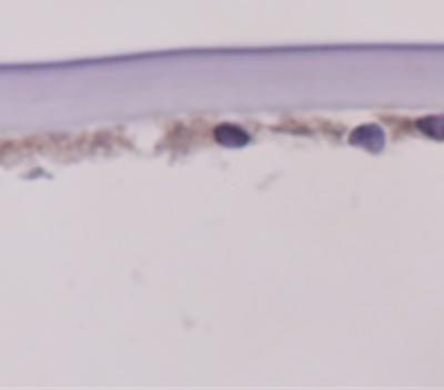 Corneal section from a person with Fuchs dystrophy shows the presence of ATP1B1 in the corneal endothelium.
