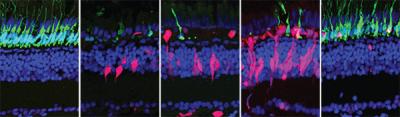 Sequence of five images, spanning 28 days, shows how regeneration happens in the zebrafish retina.  Rods are shown in green, regenerating cells are shown in red, and all other cells are labeled with blue.  As the rods die, regenerating cells increase and replace the lost rods.