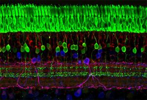 The retina has several layers of nerve cells. Photoreceptors (top, in green) are responsible for detecting light and converting it into electrical signals. Image courtesy of Wei Li, Ph.D., Unit on Retinal Neurophysiology, National Eye Institute.