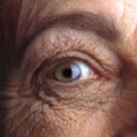 Older woman's right eye