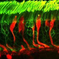 Rods and cones: Photoreceptors in a human retina