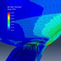 Computer simulation shows deformation caused by the eye rotating towards the nose 